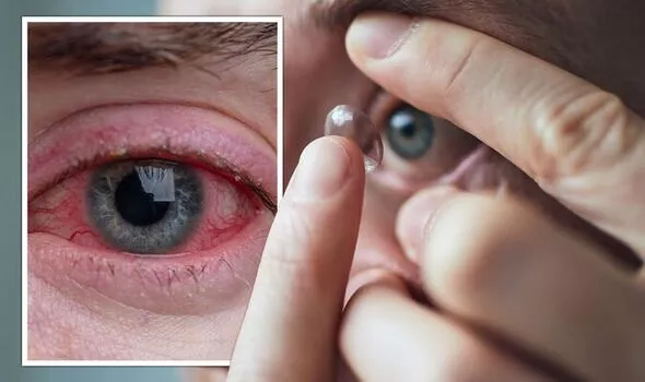 red eye caused by contacts