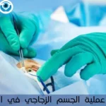 سعر عملية الجسم الزجاجي في العين