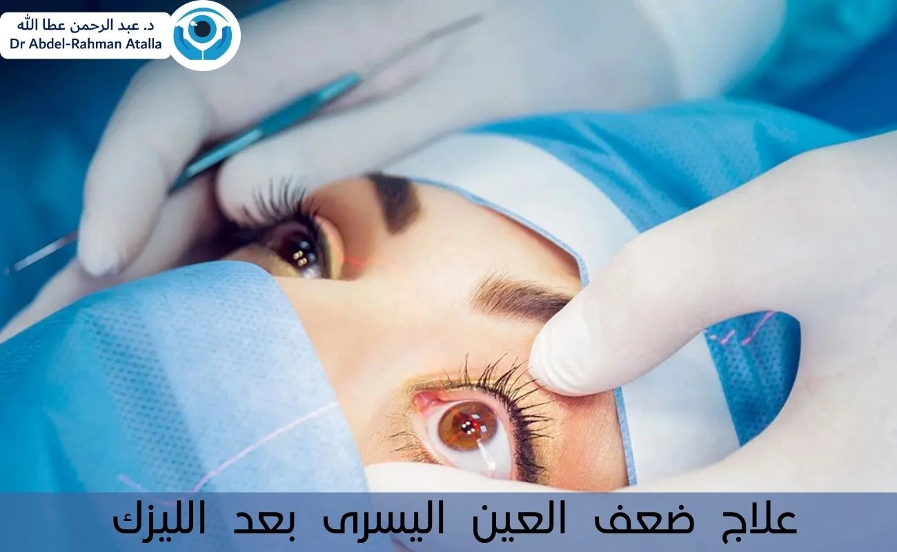 علاج ضعف العين اليسرى بعد الليزك ودواعي المتابعة الطبية