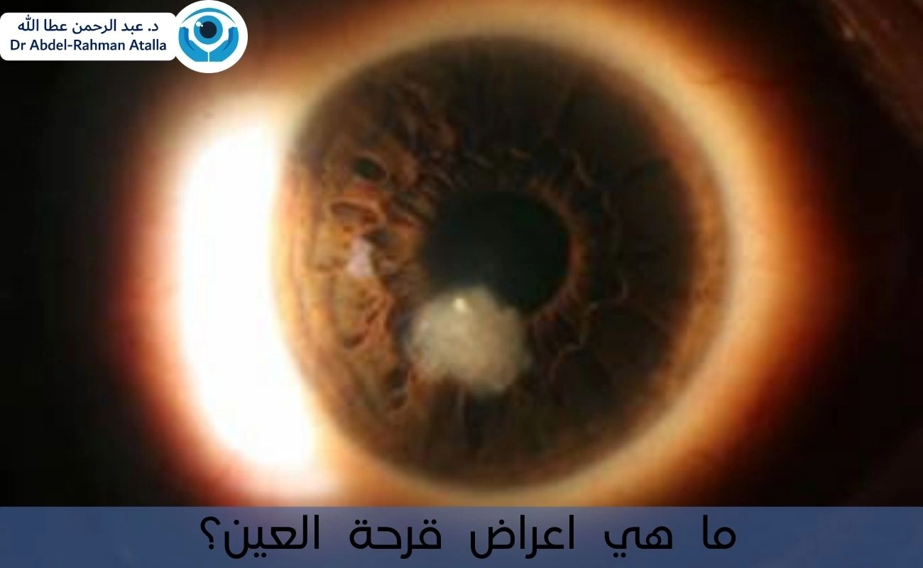 ما هي اعراض قرحة العين