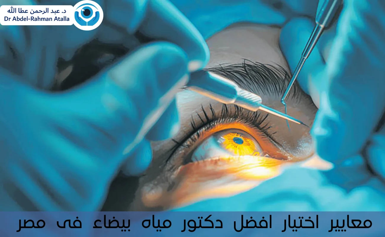 افضل دكتور مياه بيضاء فى مصر