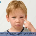 علاج انتفاخ جفن العين السفلي عند الاطفال