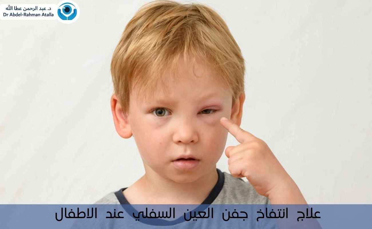 علاج انتفاخ جفن العين السفلي عند الاطفال