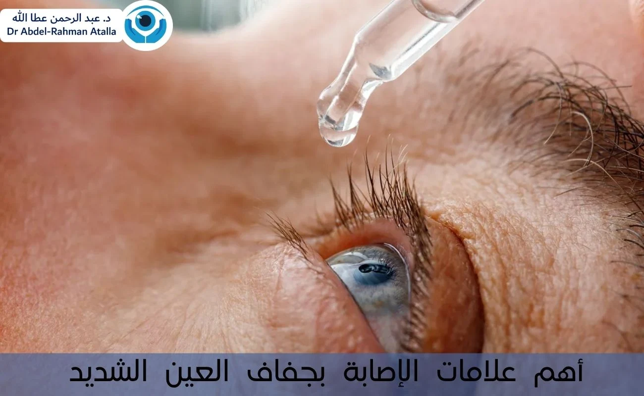كيفية الوقاية من جفاف العينين