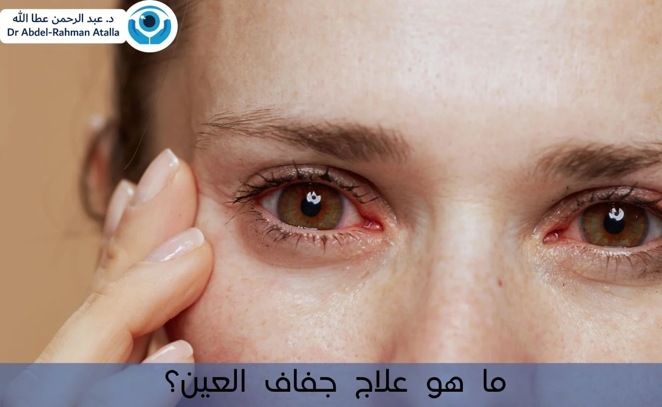 ما هو علاج جفاف العين